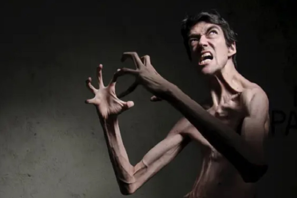 Javier Botet